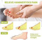 Bukihome toe straighteners worn on foot showing proper alignment positioning