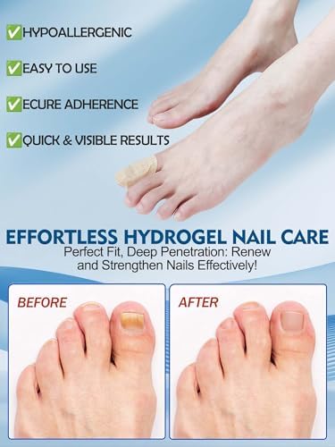Vealvion extra strength nail treatment patches for damaged nails