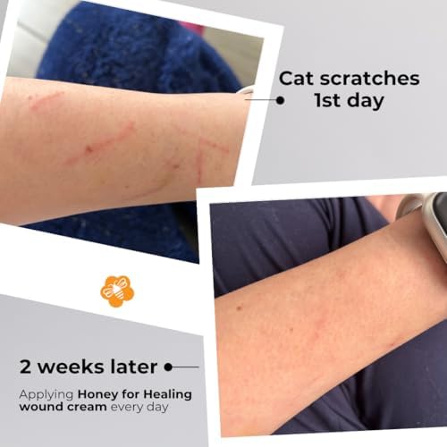 Dermatologist friendly honey cream for dry skin and blister relief