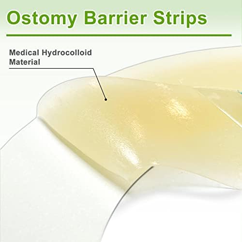 Carbou medical grade hydrocolloid strips applied securely around the edges of a stoma bag flange.