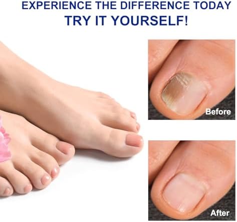 Instructions for using Minleer overnight nail repair patches