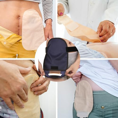 Example of how the AxuuRmvin belt conceals a stoma bag