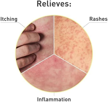 Imported PROcure anti-itch cream for insect bites and skin inflammation
