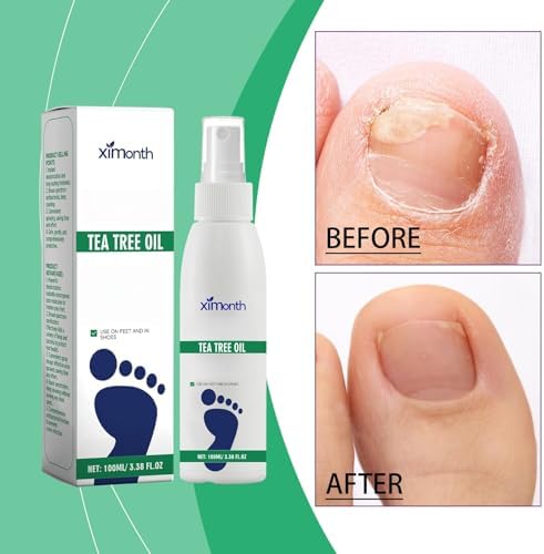 Ximonth foot and shoe freshness spray next to a gym bag for active lifestyle hygiene