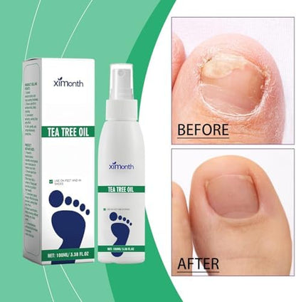 Ximonth foot and shoe freshness spray next to a gym bag for active lifestyle hygiene