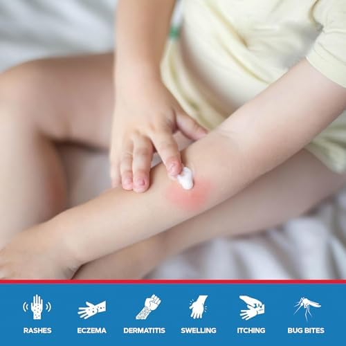 Med Pride anti-inflammatory cream for insect bites and skin rashes.