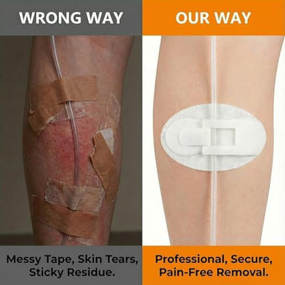 White non-woven fabric catheter stabilization device