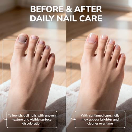 Convenient applicator stick providing assistance with precise antifungal liquid delivery
