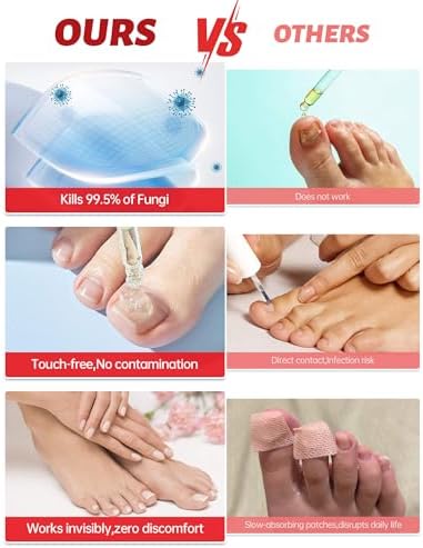 QQE antifungal nail repair liquid being applied to a discolored toenail for treatment.