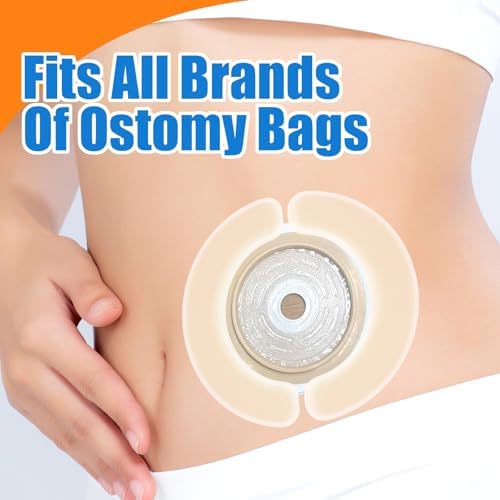 Flexible skin friendly stoma barrier extension strips for active lifestyle use