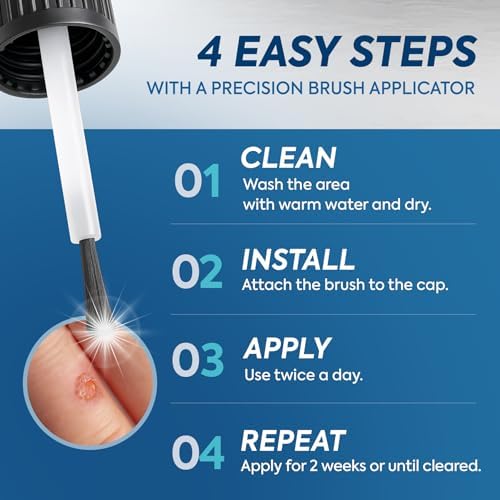 Top view of Uikeaft wart remover bottle highlighting the waterproof mask technology.