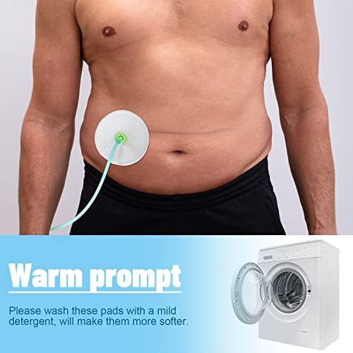 Sosation 56 piece bulk pack for abdominal feeding tubes