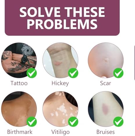 Demonstration of tattoo coverage on arm using full coverage cream