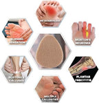 Misorita metatarsal pads packaging showing the 20 count bulk set for men and women.