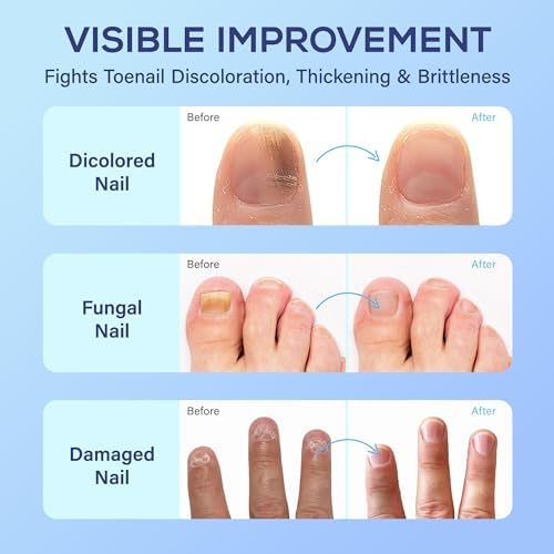 Close-up of the Pharmbanner topical antifungal solution label showing proper application directions for ingrown nails and discoloration.