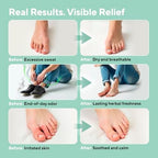Non-sticky herbal foot spray for active lifestyles and athlete foot care.