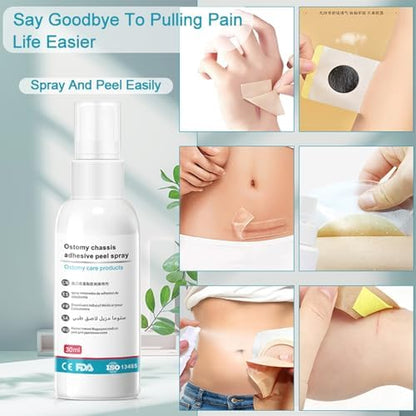 Medical grade spray removing adhesive residue from skin surface.