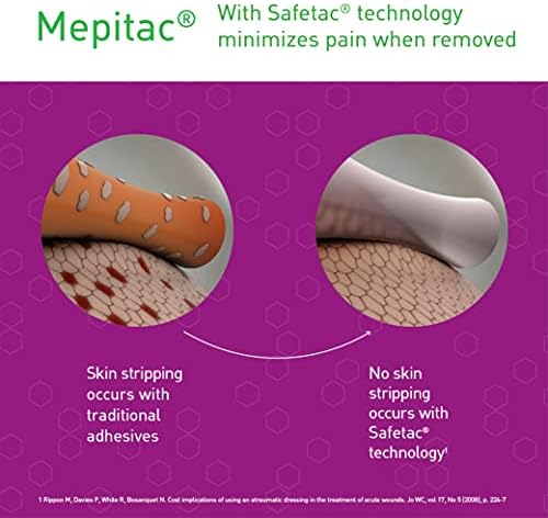 Imported Mepitac medical tape being cut to size for scar management and device stabilization