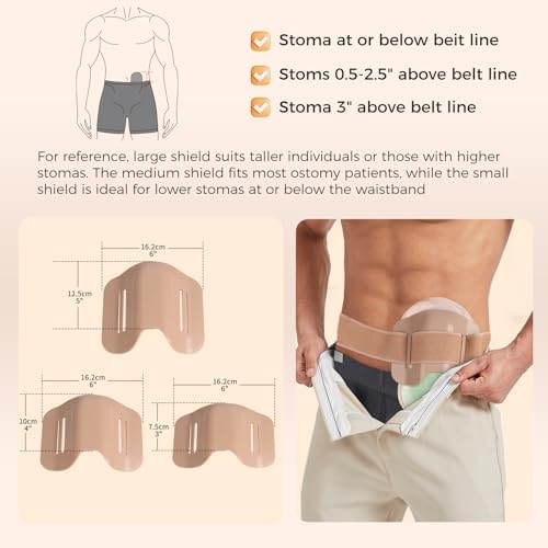 Adjustable Anti Collision Stoma Guard Kit With Three Shield Sizes