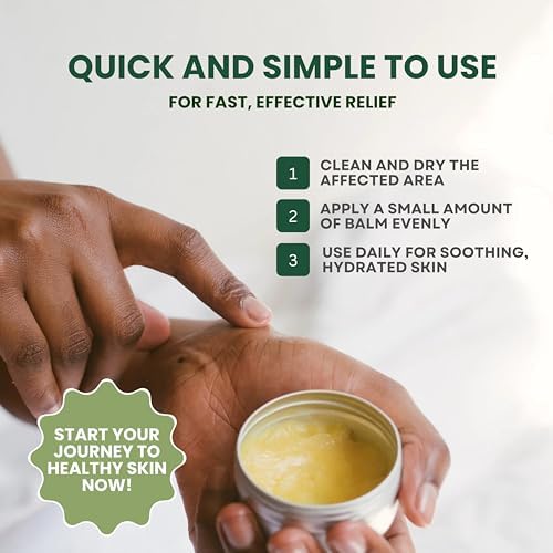 Texture and application of KESMEDIK natural relief balm for eczema