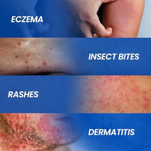 Side view of AVEDANA anti itch cream box highlighting relief for rashes and insect bites.