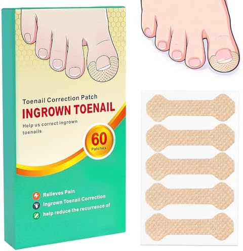Close up of an adhesive toenail corrector patch being applied to a curved toe nail for alignment.