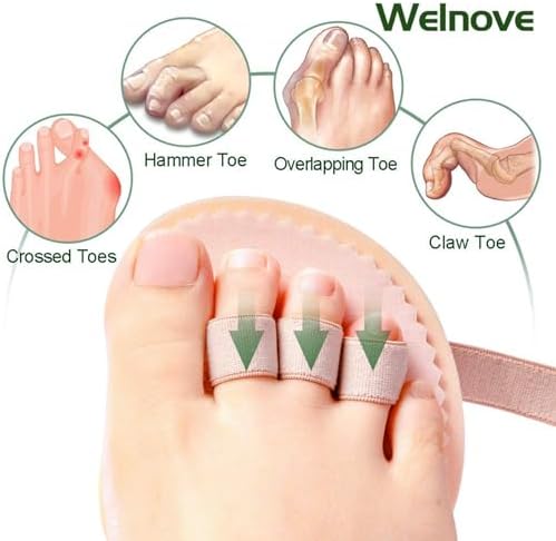 Close up of the metatarsal cushion on the Welnove hammer toe straightener.