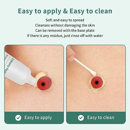 Side profile of the sting free ostomy supplies tube highlighting the cap and secure closure.