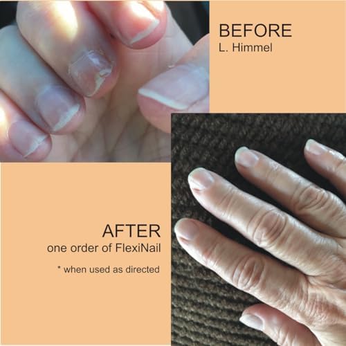 Close up of FlexiNail packaging for brittle nails