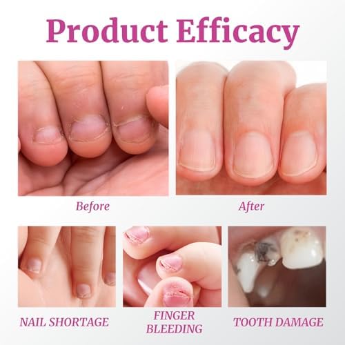 Weu L nail care bottle with brush applicator