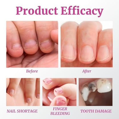 Weu L nail care bottle with brush applicator
