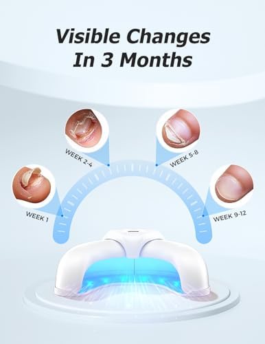 Mzvoo nail light device charging via USB cable