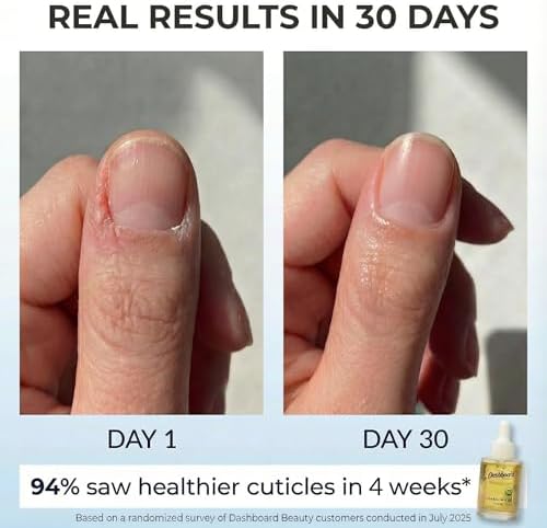 Manicure and pedicure oil providing assistance with dry and ragged skin