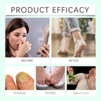 Two 100ml bottles of tea tree foot spray for travel hygiene