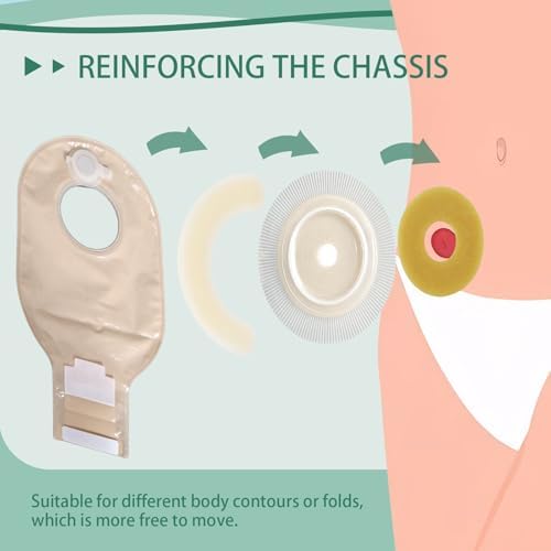Sting free hydrocolloid barrier ring being molded to fit an ileostomy and colostomy bag setup