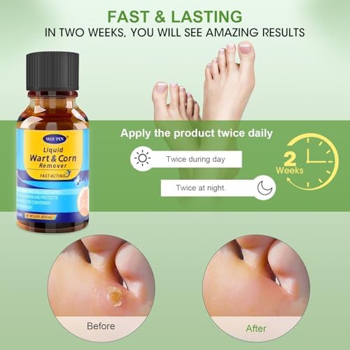 MQFORU foot corn treatment kit including 15 protective cushioning pads.
