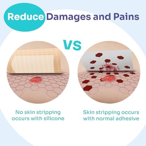Conkote highly absorbent foam dressing designed for pain-free removal.