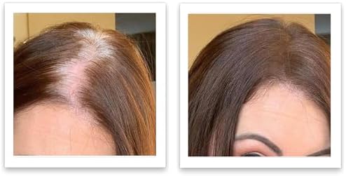 Instructions on how to apply Caboki powder to bald spots