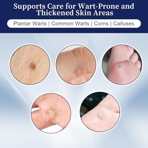 Maximum strength wart removal kit packaging showing fast-acting results