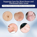Maximum strength wart removal kit packaging showing fast-acting results