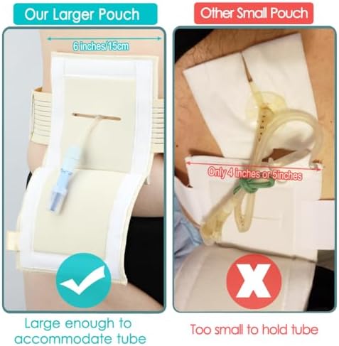 WoundWarrior PEG tube protective binder showing the large square pouch area open with a coiled tube simulator.
