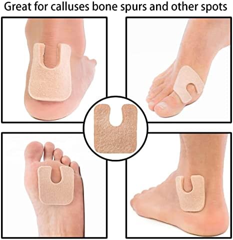 Durable medical grade felt callus cushions with adhesive backing shown in pack.