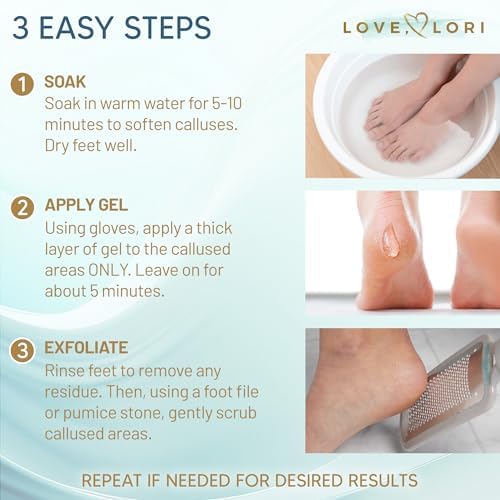 At home pedicure kit showing Love Lori callus remover and protective gloves
