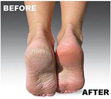 DiscoveryHealth USA imported pedicure refills in professional retail packaging.