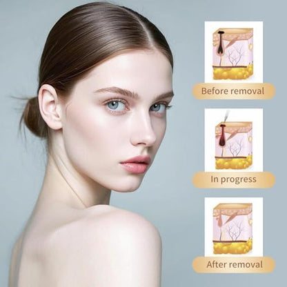 Handheld skin tag remover pen with digital LCD display showing intensity levels