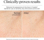 Fragrance-free non-comedogenic gel cream strengthening moisture barrier