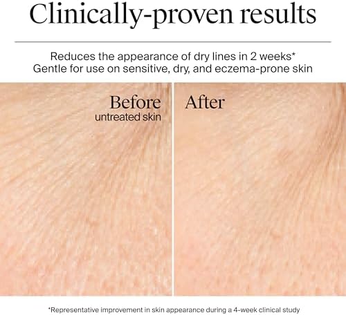 Fragrance-free non-comedogenic gel cream strengthening moisture barrier