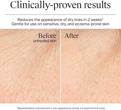 Fragrance-free non-comedogenic gel cream strengthening moisture barrier