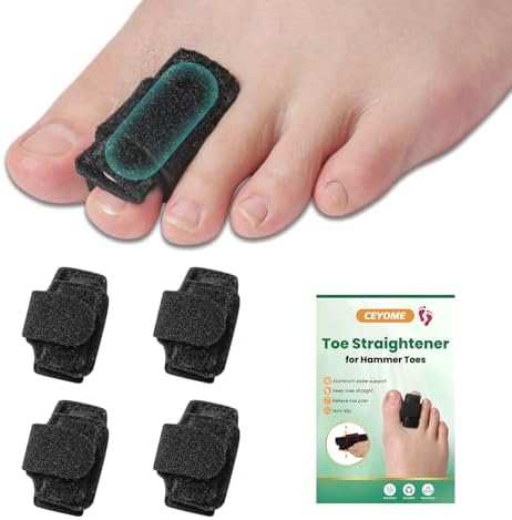 Ceyome toe splints applied to curled toes