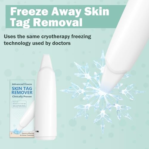 WARMAPE skin tag removal device and applicator tips for home use